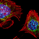 Fibroblasts, or connective tissue cells. Nuclei in blue, mitochondria in green.